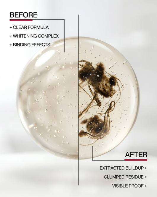 iD Stain Whitening Mouthwash