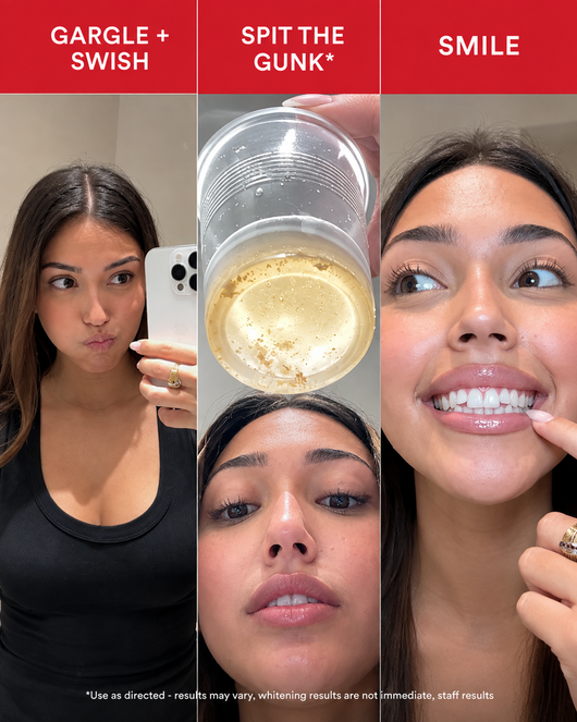 iD Stain Whitening Mouthwash